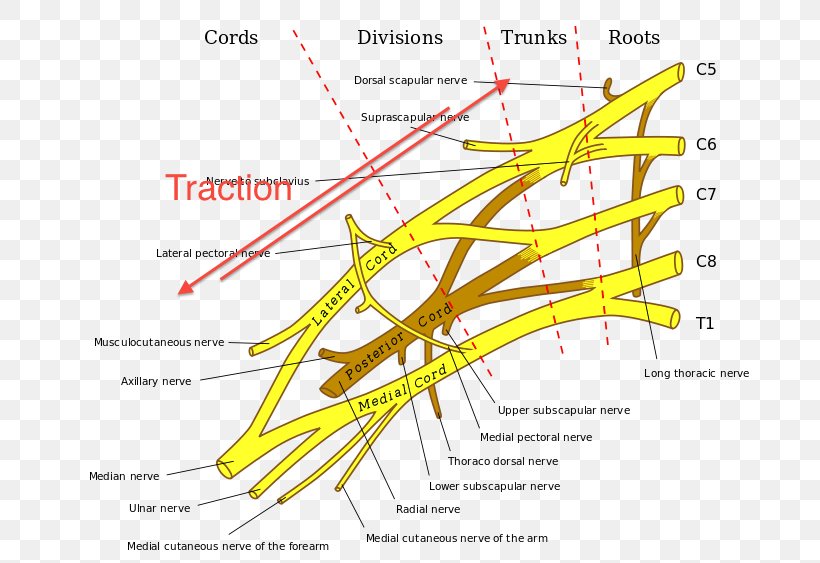 Brachial Plexus Injury Cervical Spinal Nerve 8, PNG, 750x563px, Brachial Plexus, Area, Axilla, Brachial Artery, Brachial Plexus Block Download Free