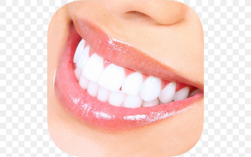 Tooth Whitening Dentistry Human Tooth, PNG, 512x512px, Tooth Whitening, Chin, Close Up, Cosmetic Dentistry, Cracked Tooth Syndrome Download Free