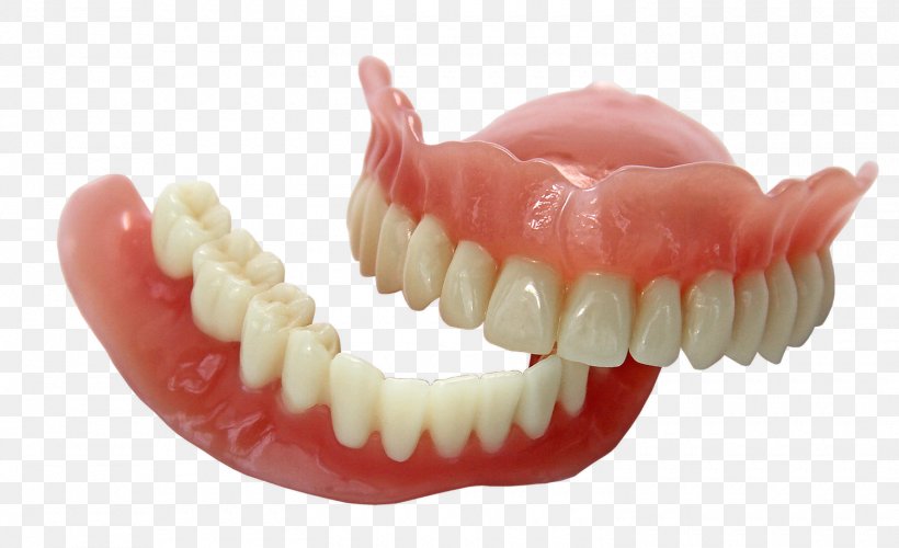 3D Printing Dentures EnvisionTEC Dentistry, PNG, 1500x916px, 3d Printing, Bridge, Cadcam Dentistry, Crown, Dental Restoration Download Free