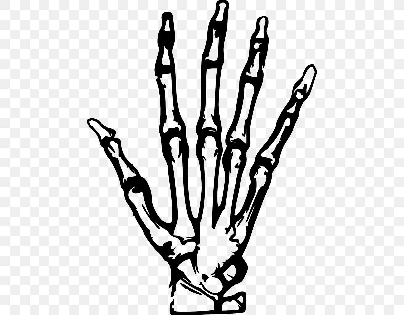 X-ray Hand Clip Art, PNG, 468x640px, Xray, Black And White, Branch, Finger, Hand Download Free