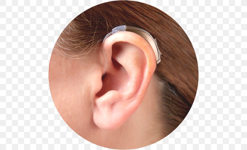 Hearing Aid Hearing Loss Acoustics, PNG, 500x500px, Ear, Acoustics, Auditory System, Cheek, Chin Download Free