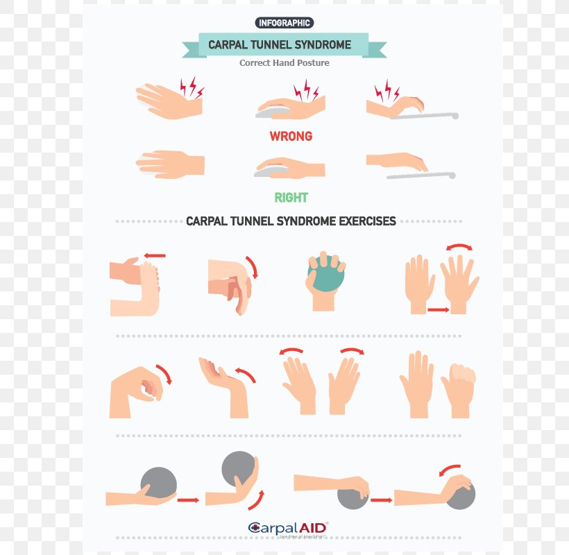 Carpal Tunnel Syndrome Exercise Hand Wrist Pain, PNG, 800x800px, Carpal Tunnel Syndrome, Carpal Bones, Carpal Tunnel, Carpal Tunnel Surgery, Exercise Download Free