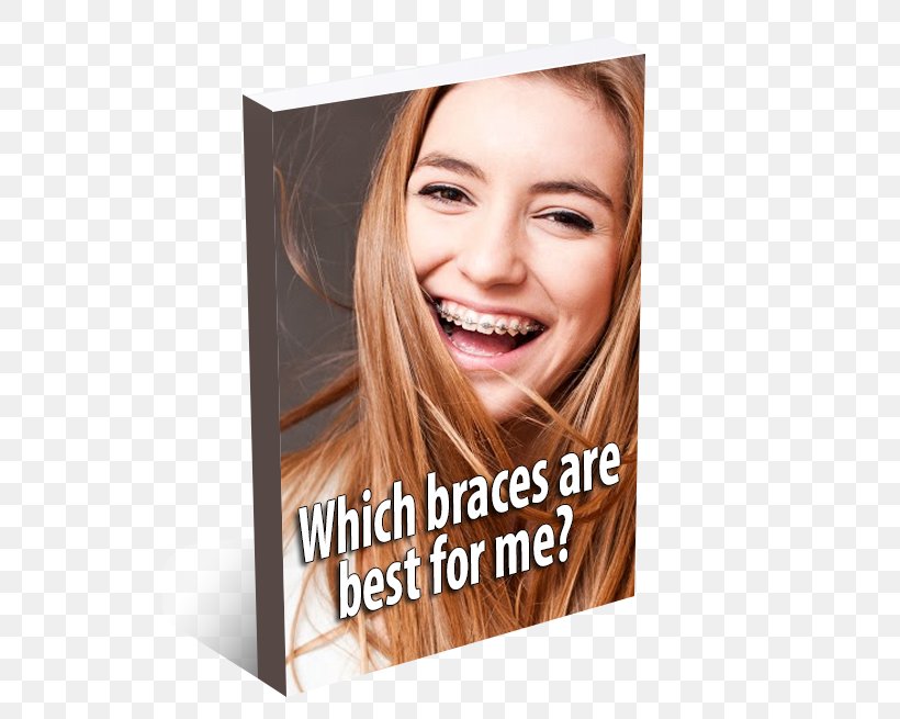 Orthodontics Dentistry Dental Braces Hawkins Complete Dental Service, PNG, 524x655px, Orthodontics, Advertising, Beauty, Blond, Bridge Download Free