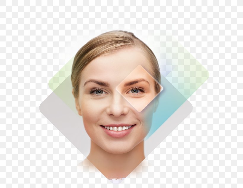 Acne Skin Face Dermatology Surgery, PNG, 765x635px, Acne, Acne Fulminans, Cheek, Chin, Dermatology Download Free