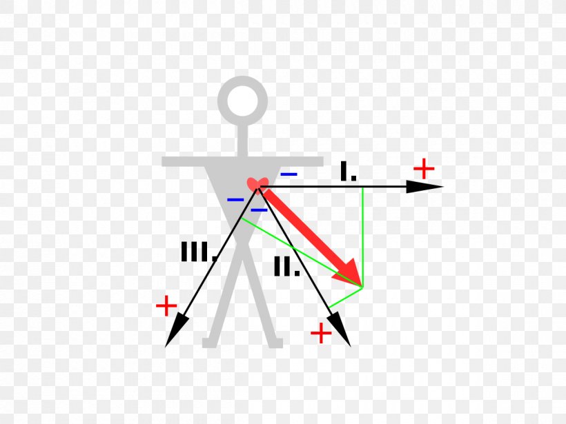 3-Lead EKG Einthoven's Triangle Electrocardiography Cardiology, PNG, 1200x900px, 3lead Ekg, Area, Brand, Cardiology, Diagram Download Free