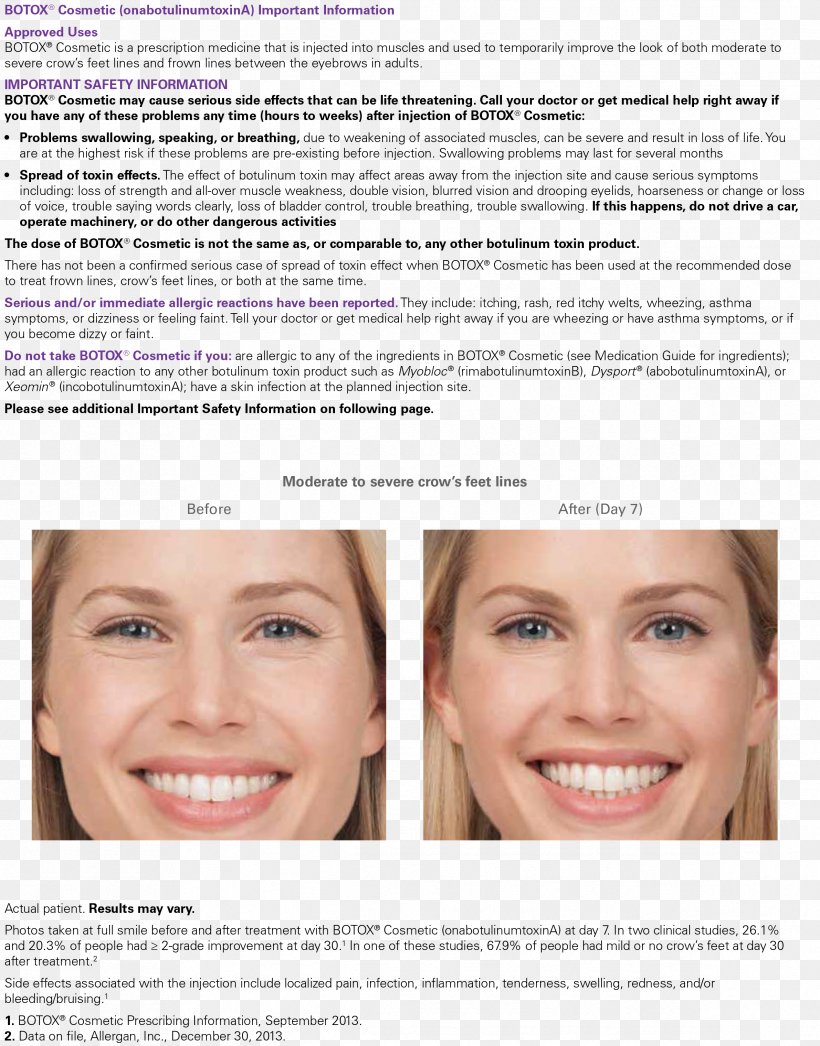 Botulinum Toxin Wrinkle Truly Skin Injection Forehead, PNG, 2382x3041px, Botulinum Toxin, Beauty, Cheek, Chin, Cosmetics Download Free