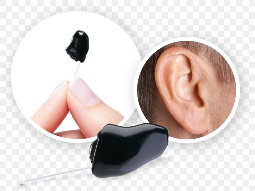 Hearing Aid Audiology Ear Canal, PNG, 1008x756px, Hearing Aid, Assistive Technology, Audio Equipment, Audiology, Disability Download Free