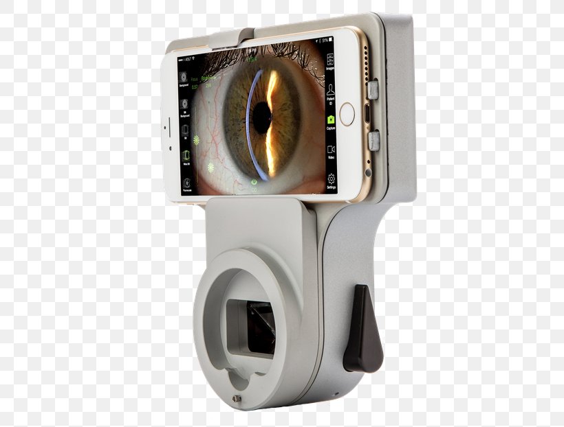 Image-forming Optical System Medical Imaging Technology, PNG, 700x622px, Imageforming Optical System, Anterior Segment Of Eyeball, Computer Hardware, Computer Network, Efficiency Download Free