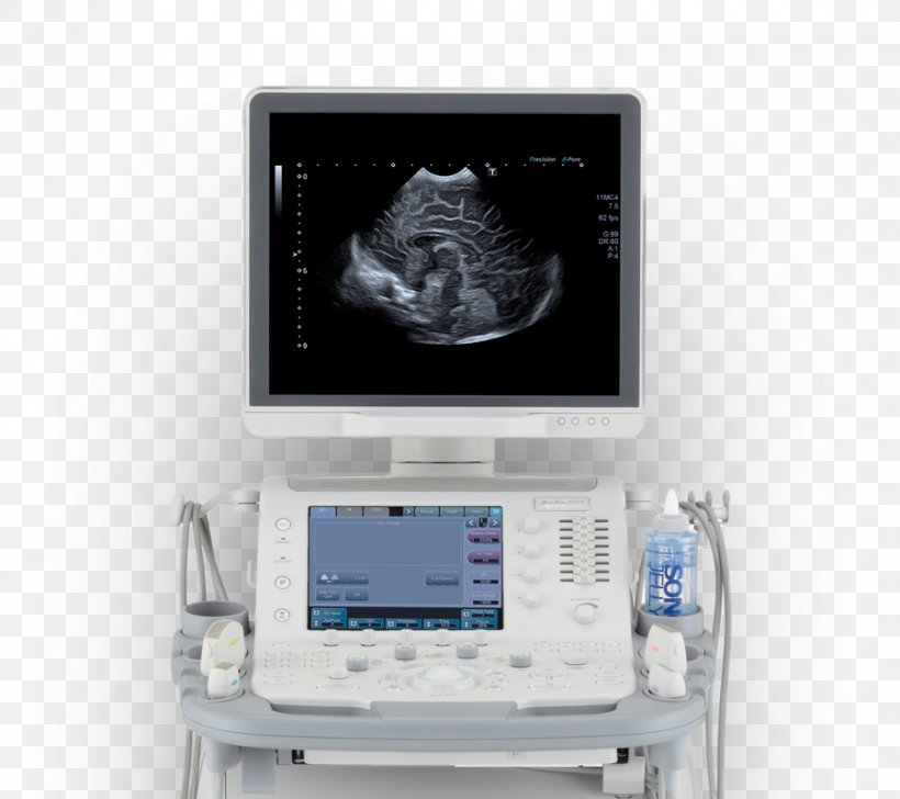 Ultrasonography Ultrasound Medical Diagnosis Patient Mindray, PNG, 900x800px, Ultrasonography, Canon Medical Systems Corporation, Display Device, Electronic Device, Electronics Download Free