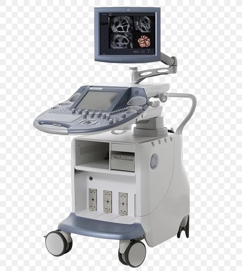Voluson 730 Ultrasonography Portable Ultrasound 3D Ultrasound, PNG, 650x917px, 3d Ultrasound, Voluson 730, Acuson, Computer Monitor Accessory, Dicom Download Free