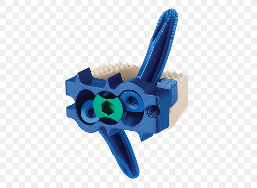 Anterior Cervical Discectomy And Fusion Interbody Fusion Cage Vertebral Column Coalition Management Information System, PNG, 600x600px, Interbody Fusion Cage, Cervical Vertebrae, Coalition, Data Management, Globus Medical Inc Download Free