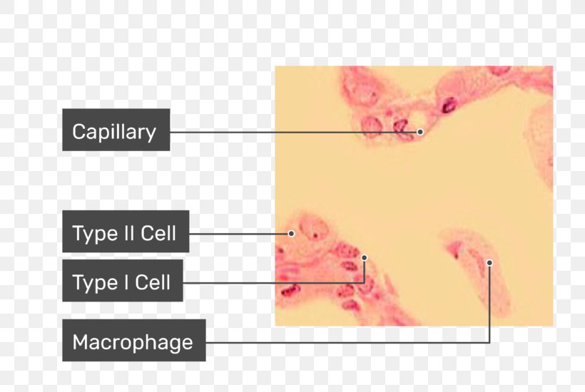 Alveolar Macrophage Pulmonary Alveolus Cell Lung, PNG, 770x550px, Macrophage, Alveolar Macrophage, Anatomy, Brand, Capillary Download Free