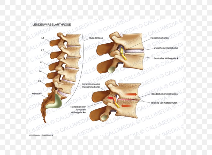 Joint Osteoarthritis Lumbar Vertebrae Process Human Back, PNG, 600x600px, Joint, Anatomy, Cervical Vertebrae, Human Anatomy, Human Back Download Free