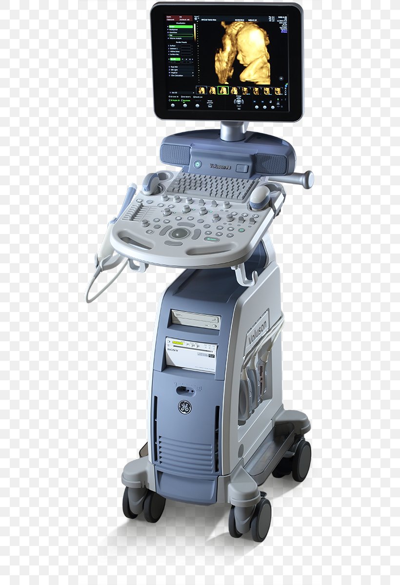 Voluson 730 Ultrasonography Ultrasound GE Healthcare Gynaecology, PNG, 620x1200px, Voluson 730, Ge Healthcare, General Electric, Gynaecology, Health Care Download Free