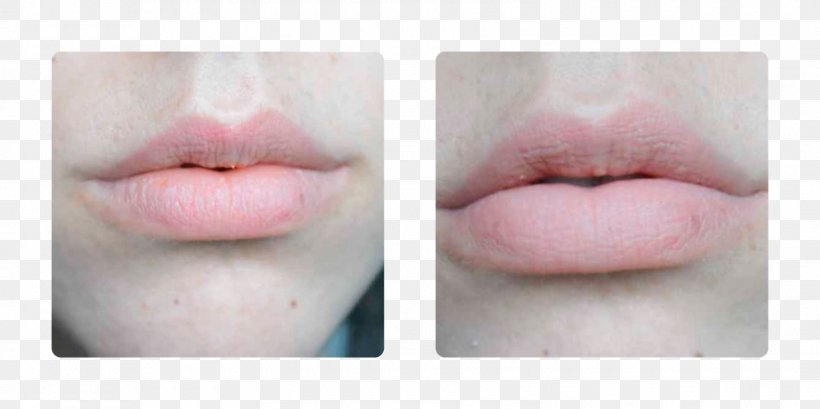 Lip Gloss Close-up, PNG, 1600x800px, Lip Gloss, Cheek, Chin, Closeup, Eyelash Download Free