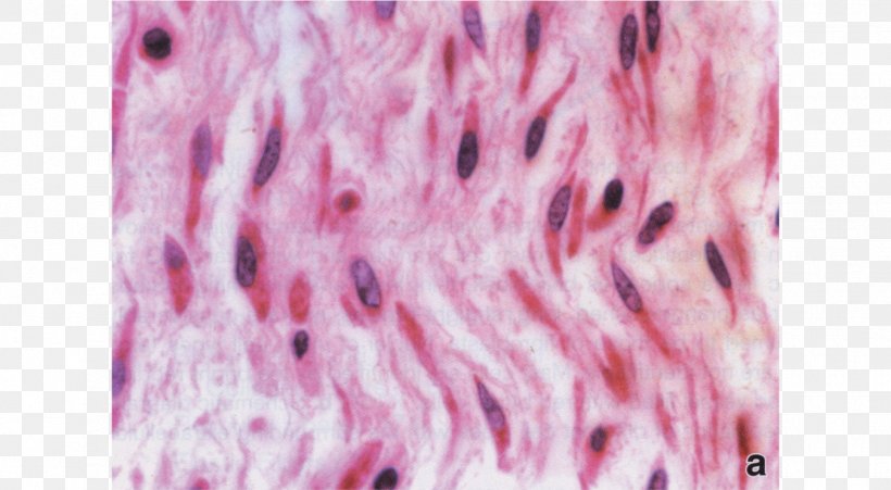 Mesenchyme Connective Tissue Extracellular Matrix, PNG, 1350x743px, Mesenchyme, Cartilage, Cell, Connective Tissue, Dye Download Free