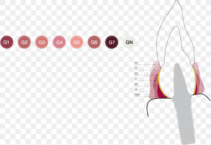 Gums Ceramic Gingival Margin Dental Porcelain, PNG, 904x621px, Watercolor, Cartoon, Flower, Frame, Heart Download Free