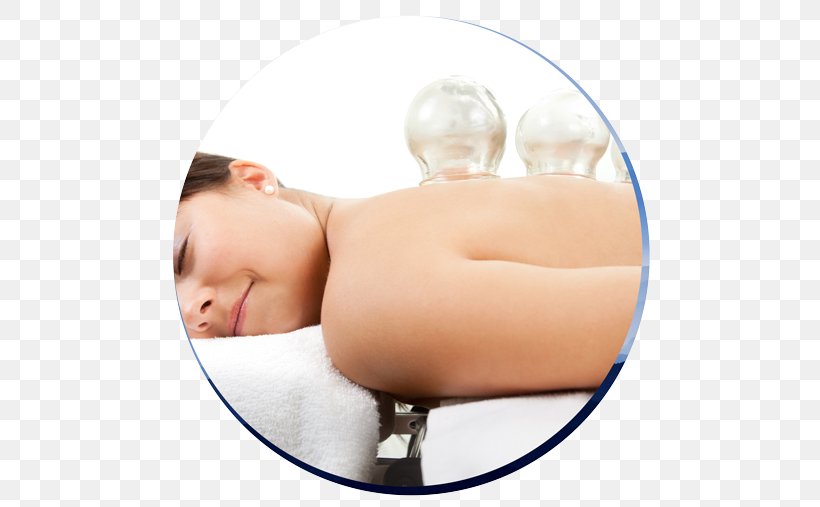 Cupping Therapy Massage Alternative Health Services Acupuncture, PNG, 500x507px, Cupping Therapy, Acupressure, Acupuncture, Alternative Health Services, Arm Download Free