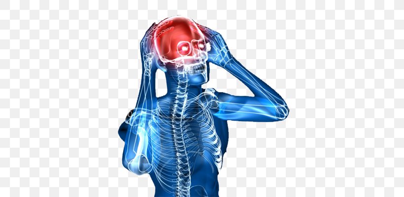 Migraine Hand Headache Disease, PNG, 376x400px, Migraine, Arm, Depression, Disease, Electric Blue Download Free