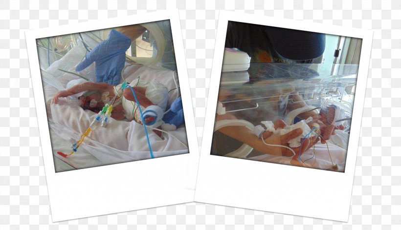 Queen Elizabeth University Hospital Neonatal Intensive Care Unit Infant Birth Plastic, PNG, 1890x1086px, Neonatal Intensive Care Unit, Andrea Prader, Art, Birth, Glasgow Download Free