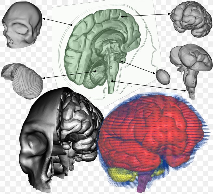 Traumatic Brain Injury Concussion Amnesia Neurosurgery, PNG, 989x904px, Watercolor, Cartoon, Flower, Frame, Heart Download Free