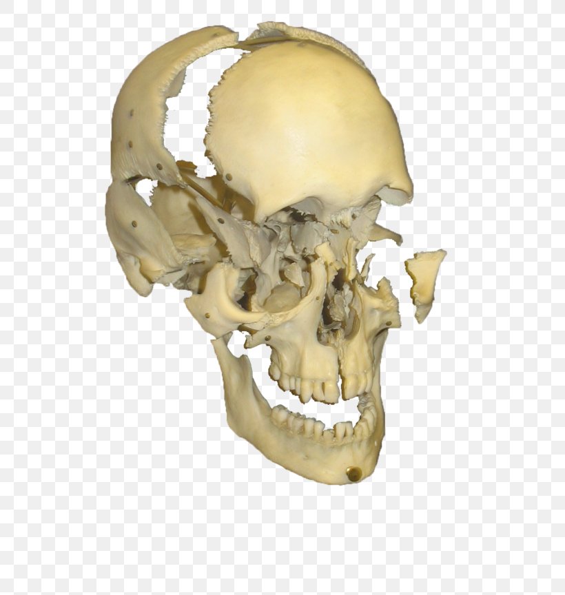 Skull Skeleton Bone Photography, PNG, 800x864px, Skull, Art, Bone, Deviantart, Human Skeleton Download Free