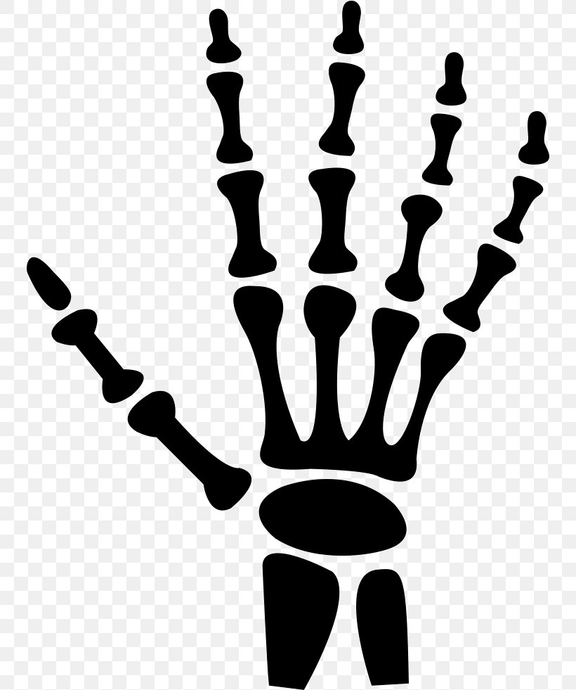 Hand X-ray Radiology Human Body, PNG, 744x981px, Hand, Black And White, Bone, Carpal Bones, Digital Radiography Download Free