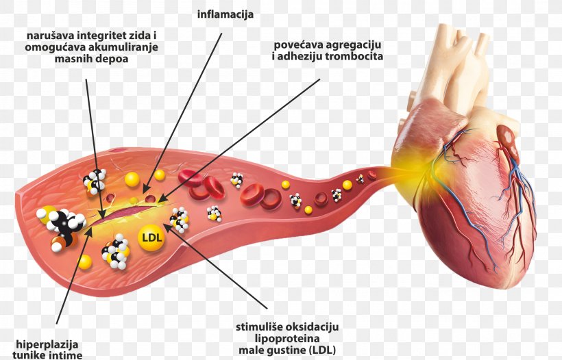 Homocysteine Blood Health Cardiovascular Disease Heart, PNG, 2199x1412px, Watercolor, Cartoon, Flower, Frame, Heart Download Free