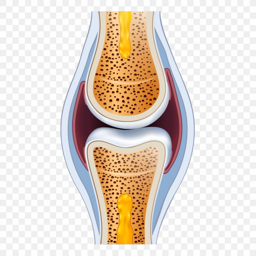 San Francisco Stem Cell Treatment Center Vitamin D Therapy Bone Calcium, PNG, 1024x1024px, Vitamin D, Arthritis Pain, Bone, Bone Health, Calcium Download Free