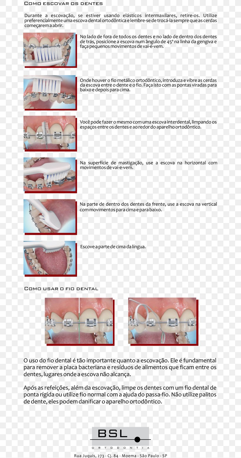 BSL Ortodontia Ltda Moema Paper Jaw Orthodontics, PNG, 700x1561px, Paper, Brush, Clinic, Human Tooth, Jaw Download Free