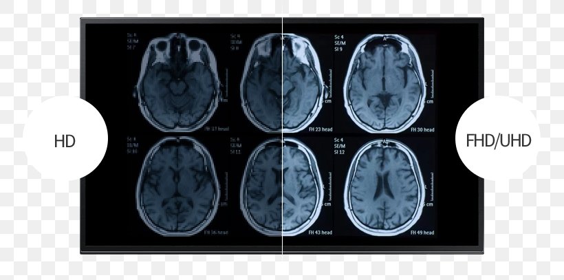 Functional Magnetic Resonance Imaging Computed Tomography Traumatic Brain Injury, PNG, 753x407px, Watercolor, Cartoon, Flower, Frame, Heart Download Free