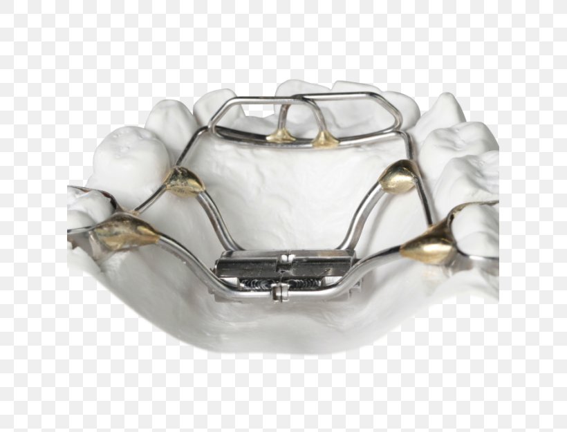 Orthodontics Palatal Expansion Cots Retainer Tongue, PNG, 625x625px, Orthodontics, Bionator, Clear Aligners, Cots, Dental Braces Download Free