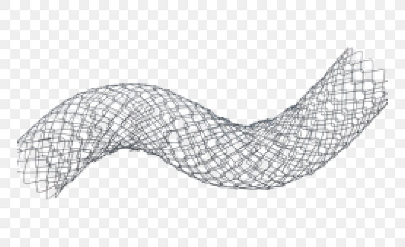 Stenting Self-expandable Metallic Stent Bare-metal Stent Medicine Duodenum, PNG, 750x499px, Stenting, Area, Arm, Baremetal Stent, Black And White Download Free