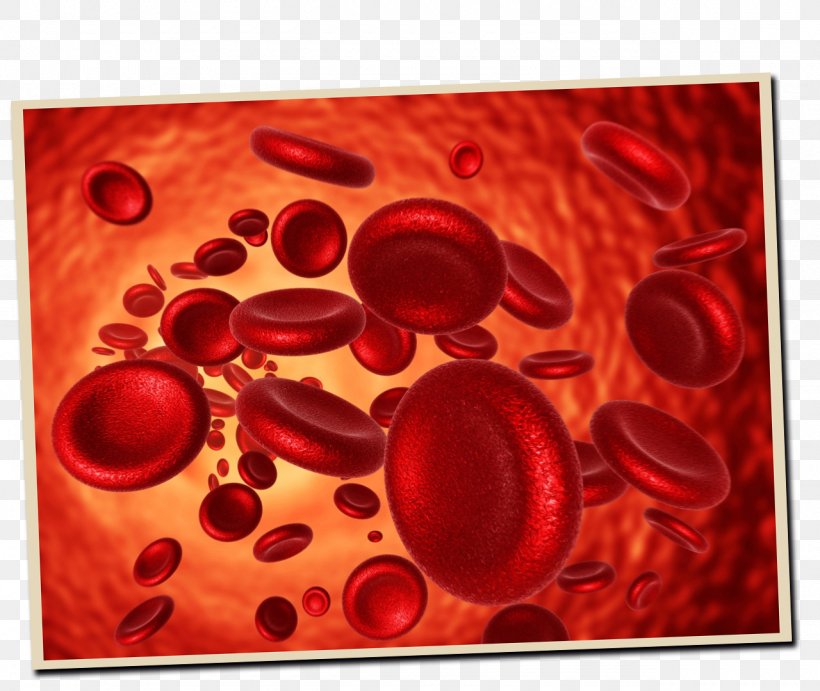 Red Blood Cell Iron-deficiency Anemia Iron Deficiency, PNG, 1280x1080px, Red Blood Cell, Anemia, Blood, Blood Cell, Cell Download Free