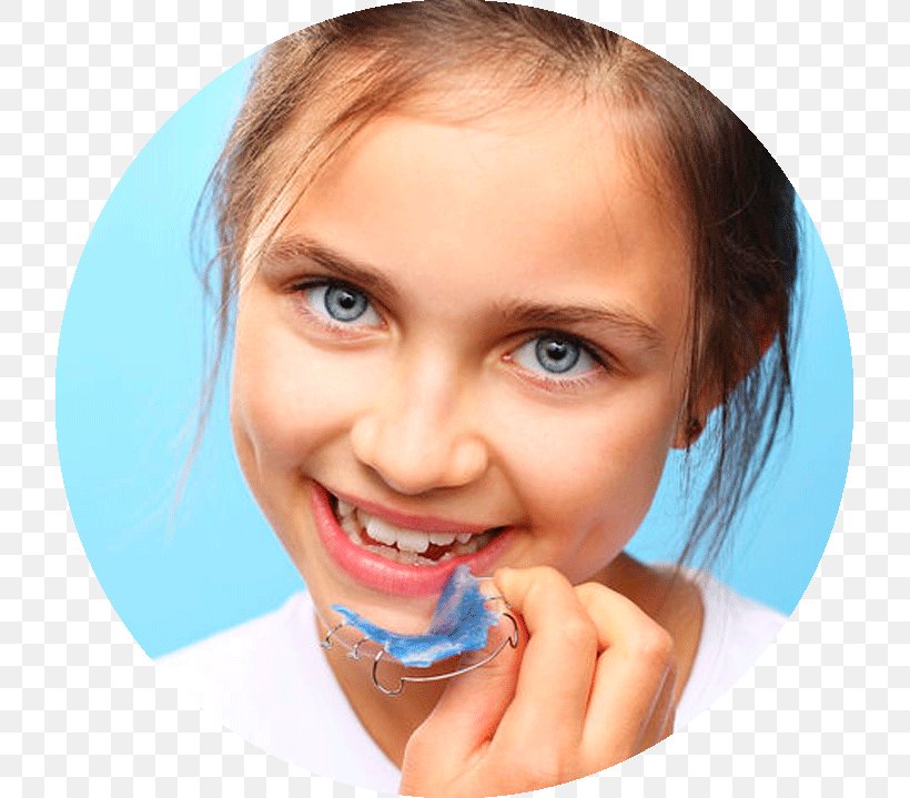 Orthodontics Dentistry Clear Aligners Retainer Dental Braces, PNG, 719x719px, Orthodontics, Cheek, Child, Chin, Clear Aligners Download Free