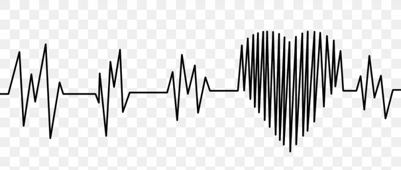 Electrocardiography Heart Rate Pulse Cardiac Muscle, PNG, 1024x434px, Electrocardiography, Black And White, Cardiac Cycle, Cardiac Monitoring, Cardiac Muscle Download Free