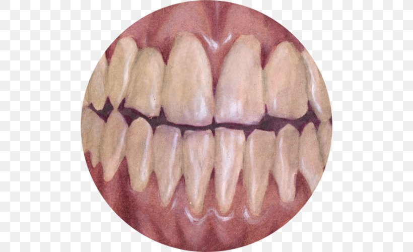 Human Tooth Homo Sapiens Sycra Clip Art, PNG, 500x500px, Tooth, Borderlands, Cartoon, Drawing, Game Download Free