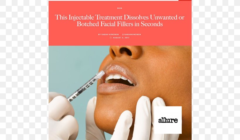 Lip Augmentation Hyaluronic Acid Injectable Filler Restylane, PNG, 640x480px, Lip, Advertising, Brand, Cheek, Chin Download Free