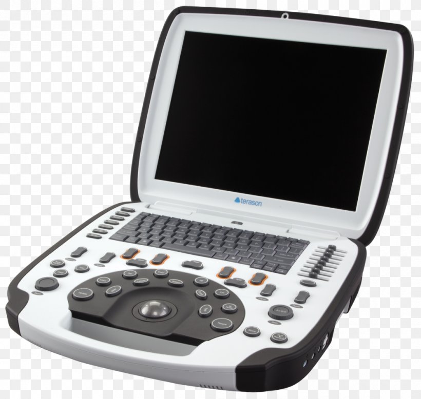 Terason Ultrasonography Portable Ultrasound TERATECH Corporation, PNG, 1000x949px, Terason, Electronic Device, Electronic Instrument, Electronics, Electronics Accessory Download Free