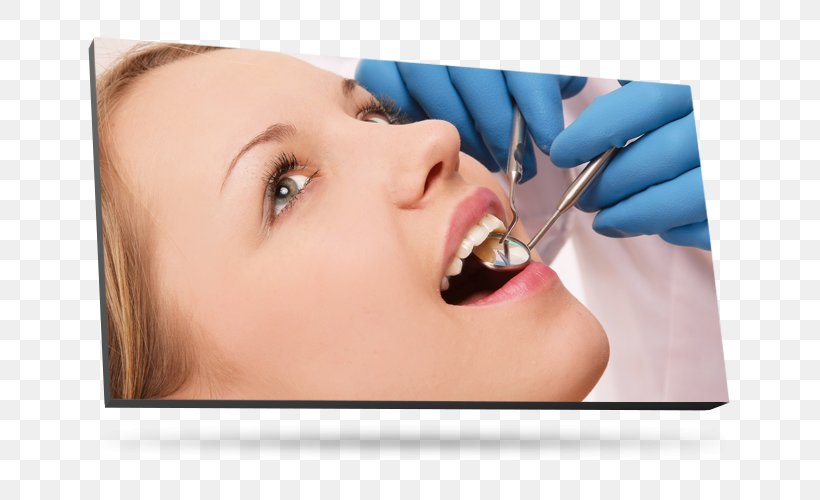 Dentistry Tooth Medicine Orthodontics, PNG, 700x500px, Dentistry, Beauty, Cheek, Chin, Close Up Download Free