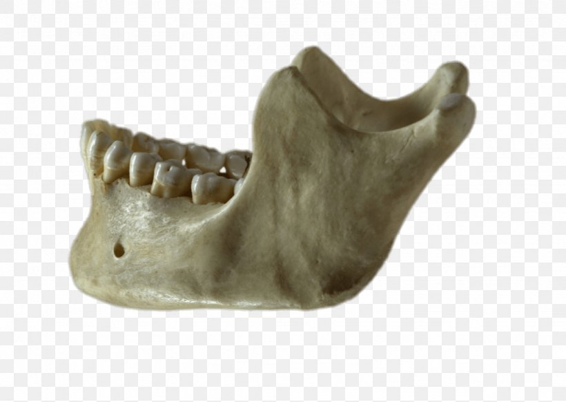 Mandible Jaw Bone Homo Sapiens Skull, PNG, 1024x728px, Mandible, Alaleuanluu, Anatomy, Bone, Homo Sapiens Download Free
