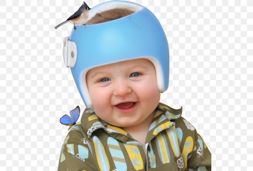 Skull Orthotics Helmet Plagiocephaly Hard Hats, PNG, 550x555px, Skull, Asymmetry, Bone, Boy, Cap Download Free