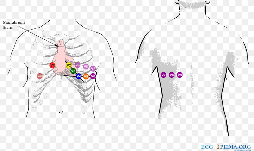 12 Lead ECG: The Art Of Interpretation Electrocardiography Electrocardiogram Heart Cardiology, PNG, 801x487px, Watercolor, Cartoon, Flower, Frame, Heart Download Free