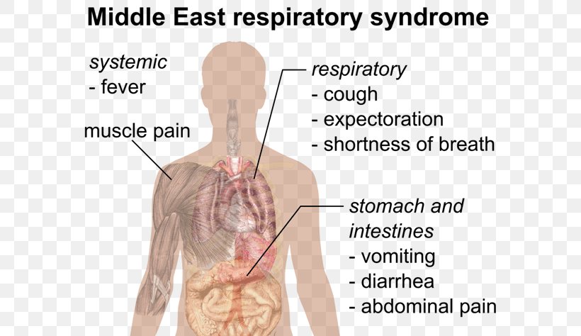 Public Health Middle East Respiratory Syndrome Severe Acute Respiratory Syndrome Pandemic, PNG, 620x474px, Watercolor, Cartoon, Flower, Frame, Heart Download Free
