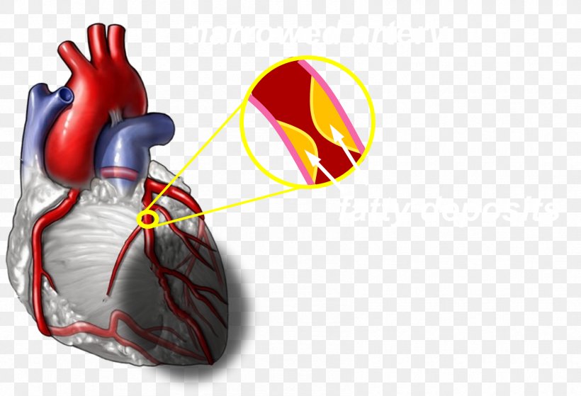 Coronary Artery Disease Heart Cardiovascular Disease Myocardial Infarction Health, PNG, 1695x1156px, Watercolor, Cartoon, Flower, Frame, Heart Download Free
