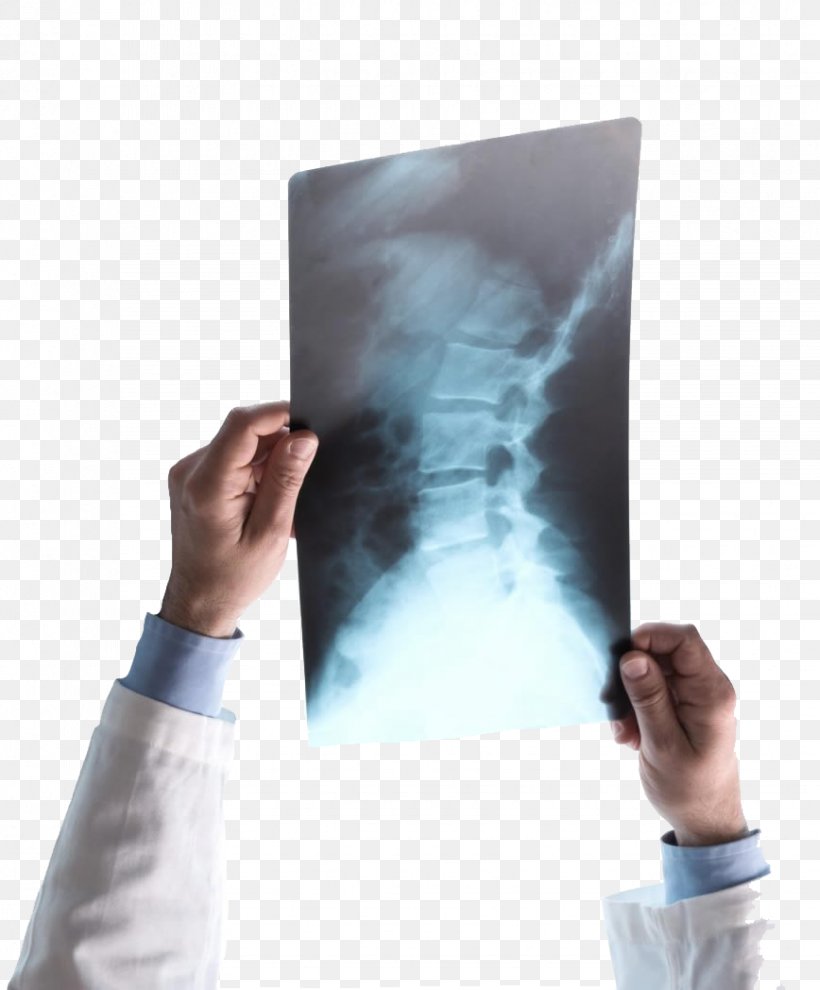 Medical Imaging Medicine Radiology Magnetic Resonance Imaging Health Care, PNG, 868x1048px, Medical Imaging, Health Care, Injury, Interventional Radiology, Magnetic Resonance Imaging Download Free