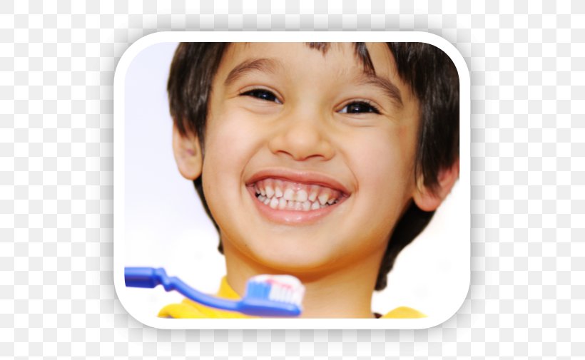 Tooth Brushing Pediatric Dentistry Child Human Tooth, PNG, 587x505px, Tooth Brushing, Cheek, Child, Chin, Close Up Download Free