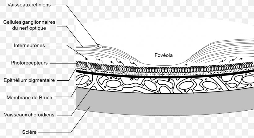 Choroid Uveal Melanoma Retina Human Eye, PNG, 1263x691px, Choroid, Area, Auto Part, Blood Vessel, Epithelium Download Free