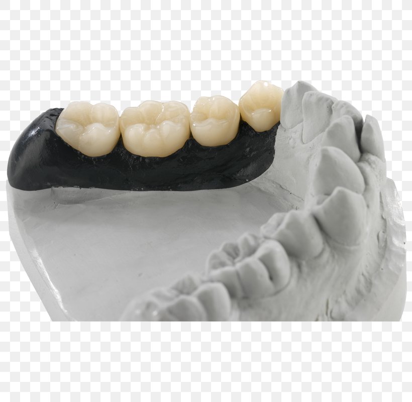 Dentist Dental Technician Dental Laboratory Anatomická Pinzeta Zahntechnik, PNG, 800x800px, Dentist, Computeraided Design, Dental Laboratory, Dental Technician, Jaw Download Free
