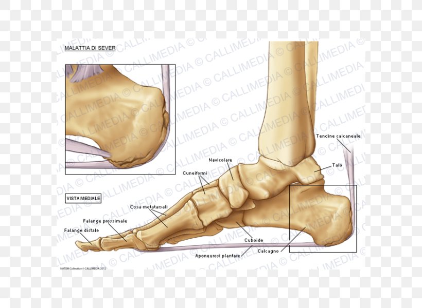 Foot Köhler Disease Bone Osteochondrosis, PNG, 600x600px, Watercolor, Cartoon, Flower, Frame, Heart Download Free